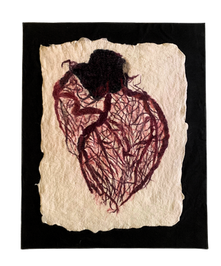 Dissections - Heart (Framed)