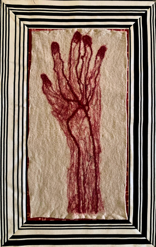 Dissections - Hand (Framed)