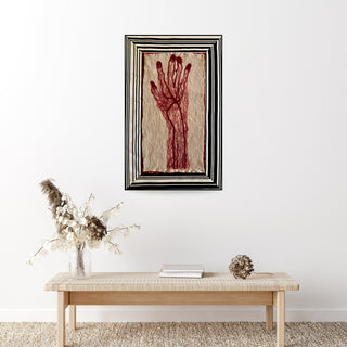 Dissections - Hand (Framed)